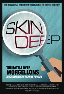 دانلود مستند Skin Deep: The Battle Over Morgellons 2019104233-1852456624